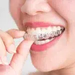 2-50Pcs Anti Snoring Bruxism Sleeping Mouth Guard Night Guard Gum Shield Mouth Tray Stop Teeth Grinding Sleep Aid Health Care - Image 4
