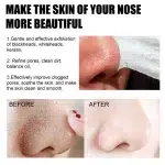 New Blackhead Removal Nose Mask Pore Patch Blackhead Mask Exfoliating Blackhead Deep Cleansing Skin Care Beauty Health - Image 4