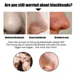 New Blackhead Removal Nose Mask Pore Patch Blackhead Mask Exfoliating Blackhead Deep Cleansing Skin Care Beauty Health - Image 3
