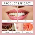 Fresh Mouthwash Effectively Removes Bad Breath and Odor, Alcohol-free Fresh Breath, Cleans Teeth and Mouth, Fresh Oral Care - Image 2