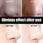 New Blackhead Removal Nose Mask Pore Patch Blackhead Mask Exfoliating Blackhead Deep Cleansing Skin Care Beauty Health - Image 2